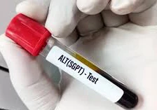 آزمایش ALT چیست؟