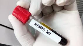 آزمایش ALT چیست؟